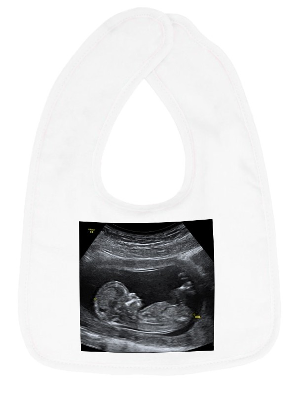 Baby Slabbetje met Foto Opdruk